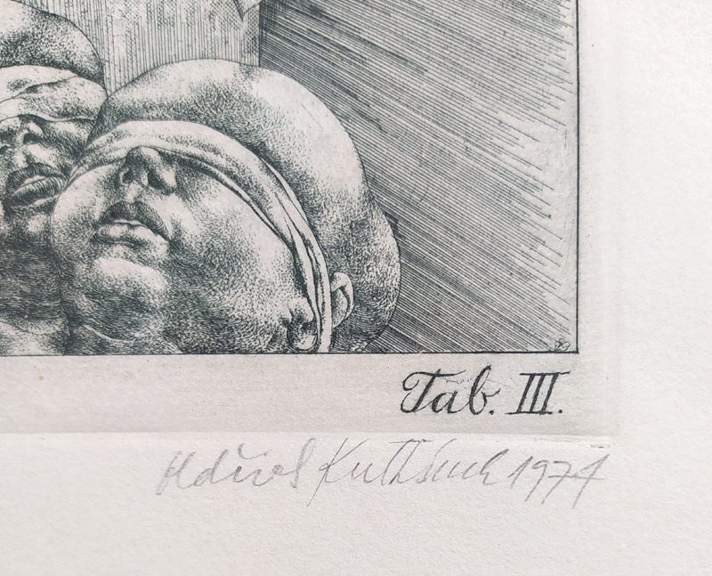 Kulhánek Oldřich – Die kleine Anatomie, Tab. III., původní lept, číslováno 18/30, 1974